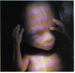 F.14_weeks-259x253