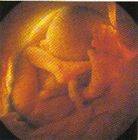 L._32_weeks-196x198